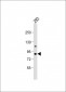 PKC epsilon Antibody (N-term)
